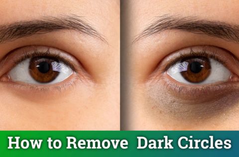 Dark Circles Under Eyes - gitaayurvedic.com