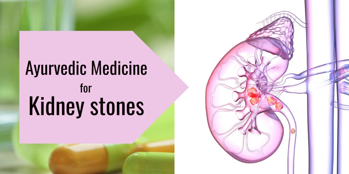 kidney Stone disease - gitaayurvedic.com