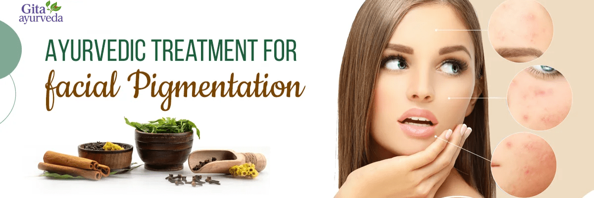 Pigmentation on Face: Causes & Ayurvedic Solutions | Complete Guide - gitaayurvedic.com