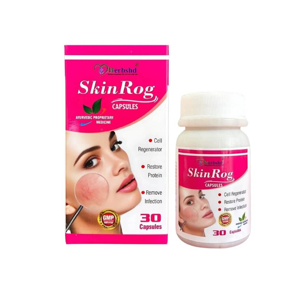 Ayurvedic Medicine For Skin Allergy (Combo Kit) - Allergic Rhinitis