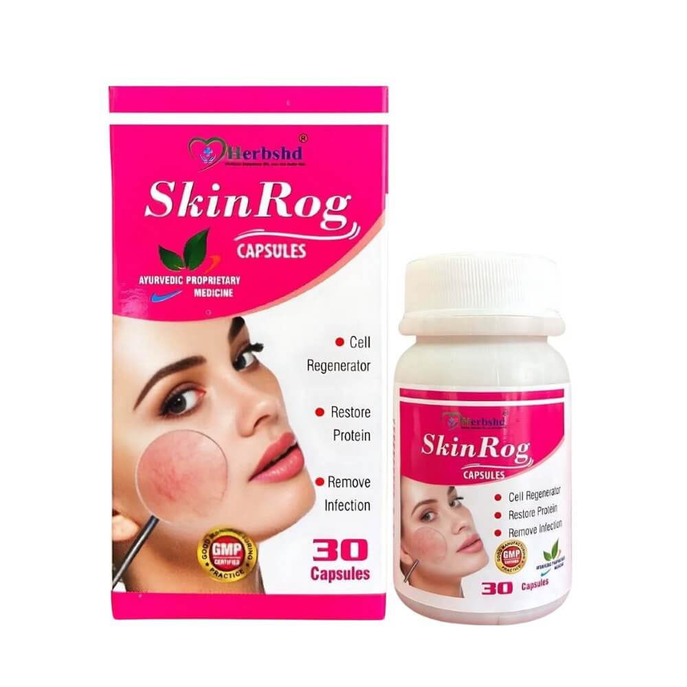 Ayurvedic Skinrog Capsule for Healthy Skin