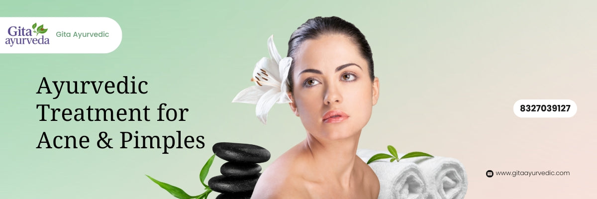 Ayurvedic Treatment for Acne & Pimples