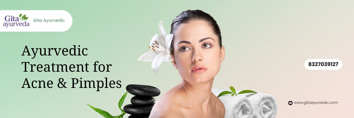 Ayurvedic Treatment for Acne & Pimples: Best Natural Remedies for Clear, Glowing Skin - gitaayurvedic.com