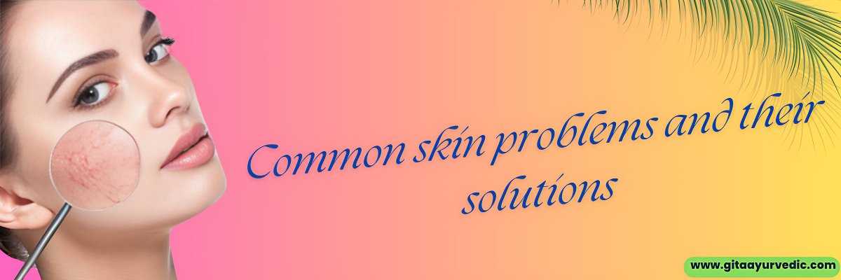 Common skin problems and their solutions