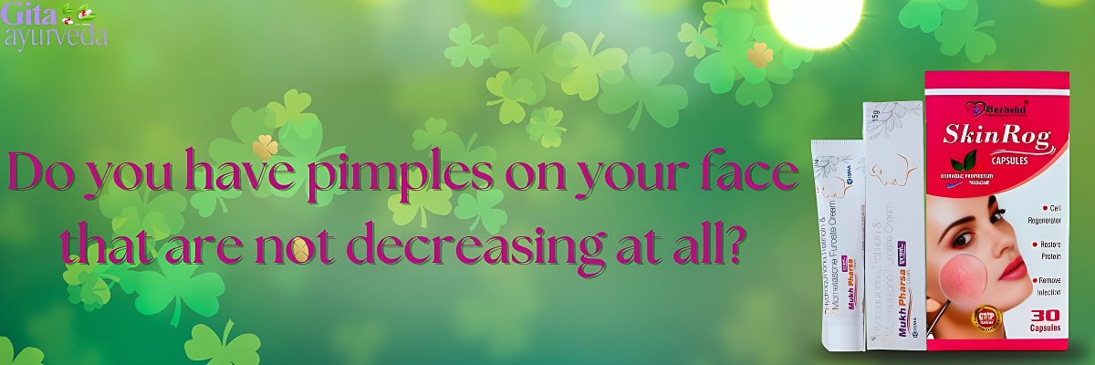 Do you have pimples on your face that are not decreasing at all? - gitaayurvedic.com