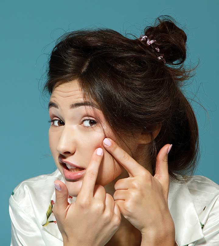 home remedies for pimples - GITA