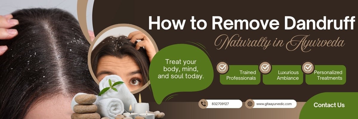 How to Remove Dandruff Naturally in Ayurveda (Complete Guide) - gitaayurvedic.com