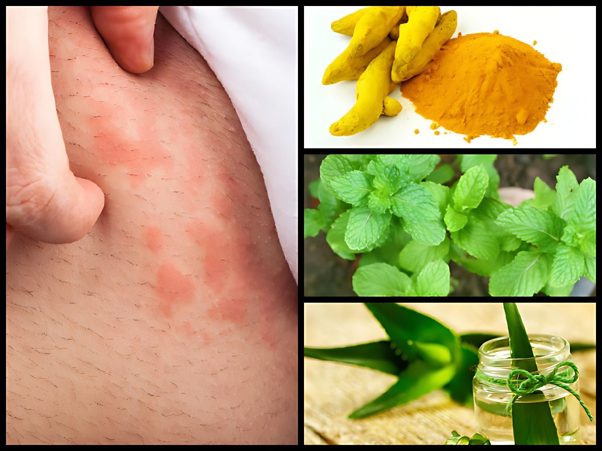 How to treat skin allergies at home - gitaayurvedic.com