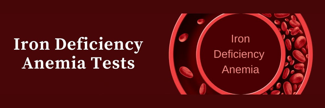 Iron deficiency anemia - GITA