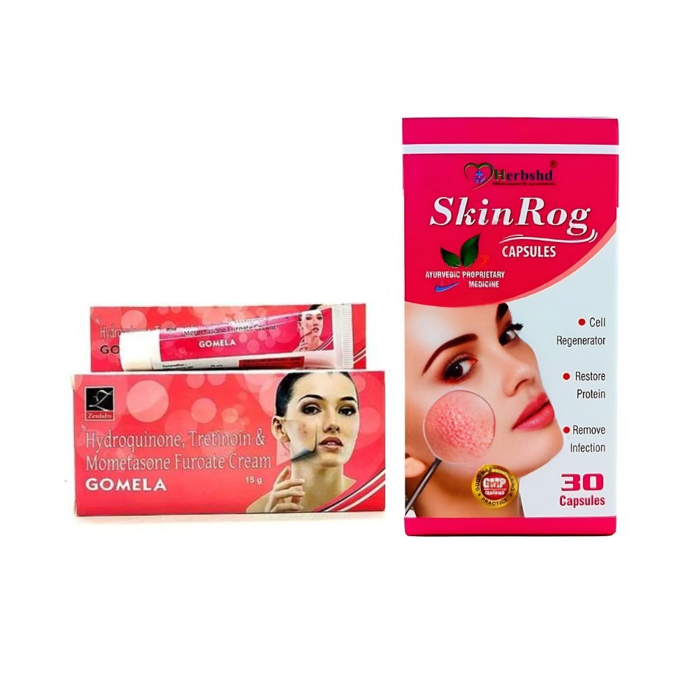 Gomela Skin Care Cream & skin rog capsule