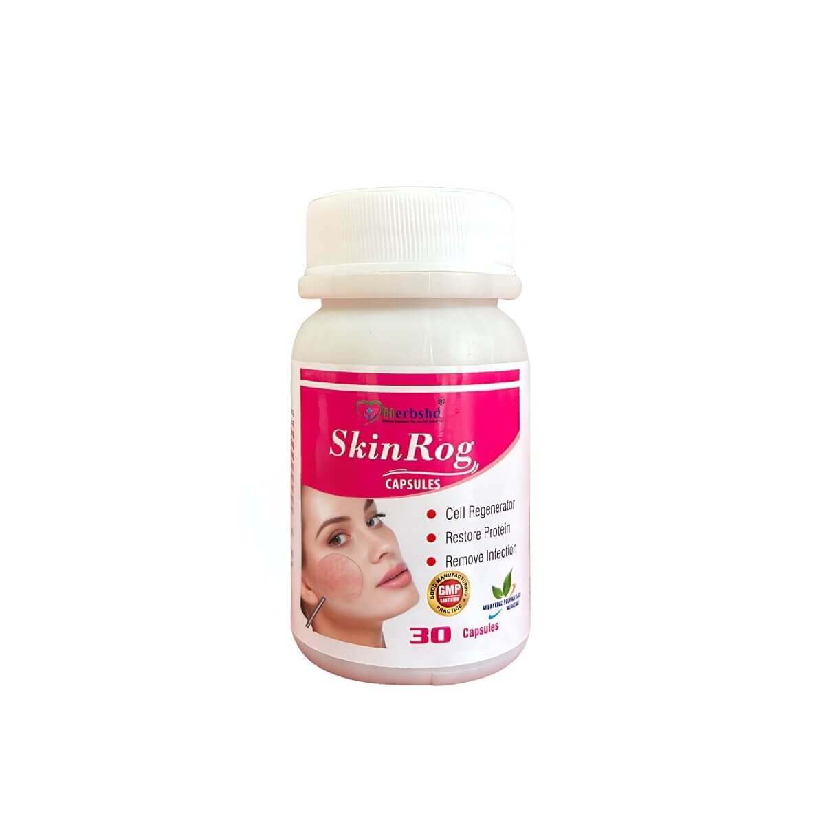 Skin Rog Capsule Helps To Remove Dark Spots On The Face (Pack off 2)