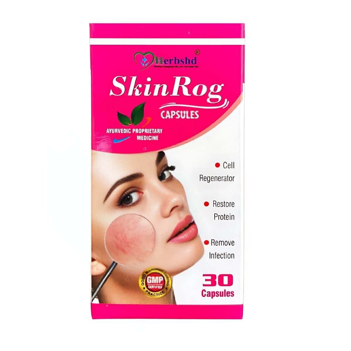 Skin Rog Capsule Helps To Remove Dark Spots On The Face (Pack off 2)