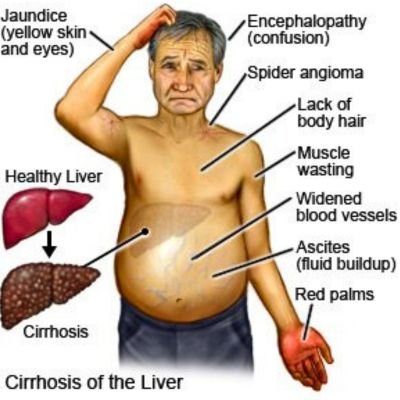 Ayurvedic Livoguard Liver Powder provides effective constipation relief for a healthy digestive system in gitayurvedic.com